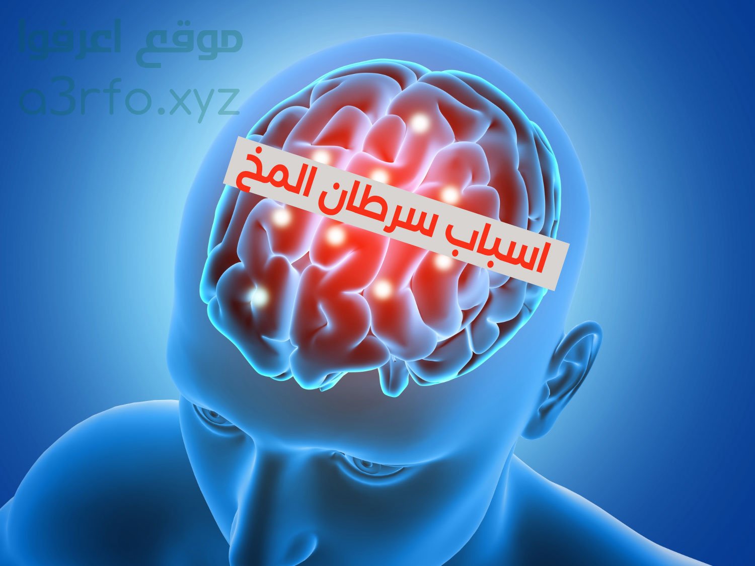 سرطان المخ , سرطان العقل , اسباب سرطان الدماغ , ما هوا سرطان الدماغ