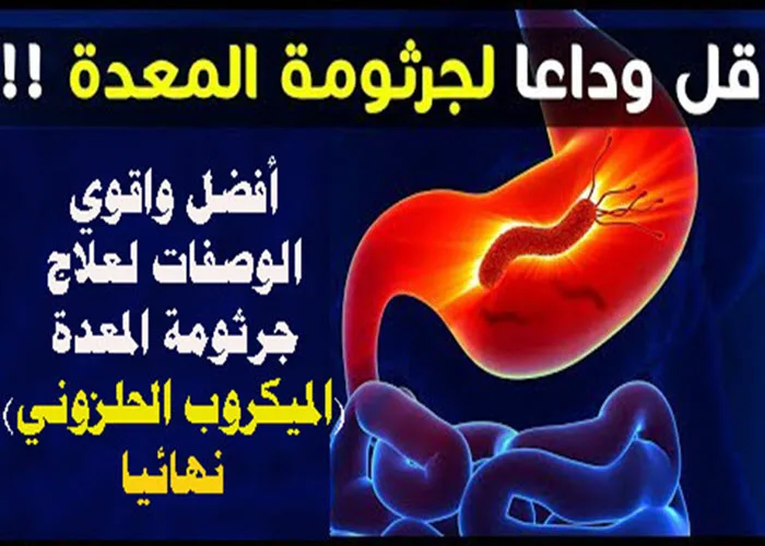علاج واعرض جرثومة المعدة