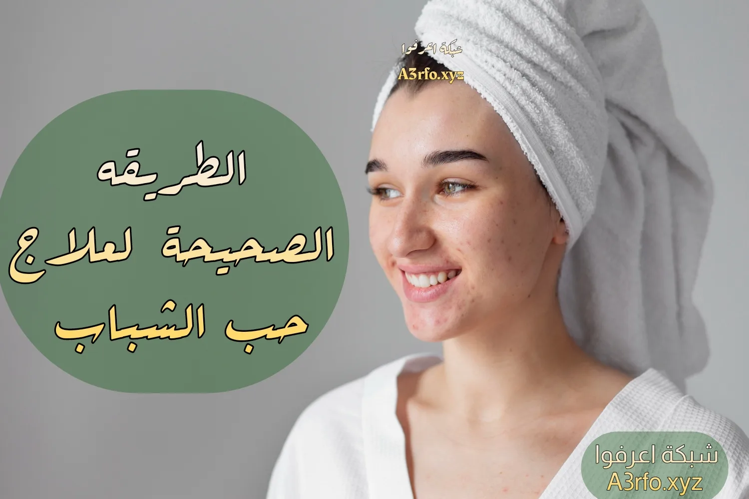 علاج حب الشباب